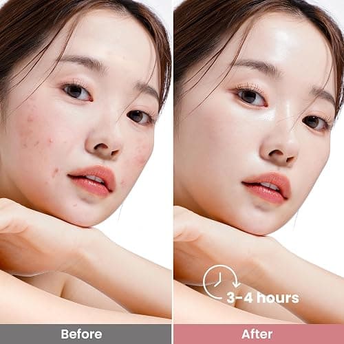 Elvira Bio-Collagen Face Mask - Deep Hydrating Overnight Face Mask, Korean Skincare, Facial Treatments & Masks for Women - Firming and Moisturizing, 4-Pack thumbnail 6