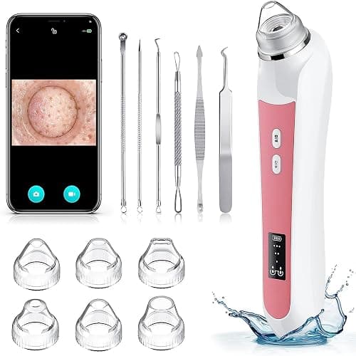 Blackhead Remover Vacuum, USB Interface Type Pore Vacuum, Black Head Extractions Tool with Camerafor, Men and Women Pore Cleaner, 3 Adjustment Modes & 6 Suction Heads(Light Pink) - Image 1