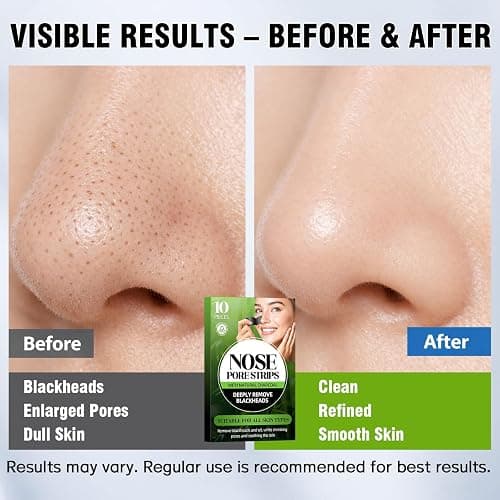 Shaeva Natural Charcoal Pore Strips, Blackhead Remover Strip, for Oily Skin, Strawberry Nose, Deep Clean & Shrinking Pores & Smoothing Skin (10 pcs) thumbnail 2
