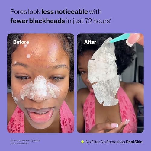 Peach Slices - Nose Pore Patches (7 ct) - Overnight Blackhead Remover - Pore Strips - Absorbs Gunk - Thin, Flexible & Painless - Hydrocolloid Patches - Vegan & Cruelty Free - Korean Skin Care & Beauty thumbnail 6