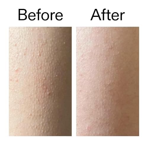 The INKEY List Glycolic Acid Exfoliating Body Stick 45g | 7% Glycolic Acid and Salicylic Acid Exfoliator, Targets Ingrown Hairs and Rough Body Skin, Suitable for All Skin Types thumbnail 7
