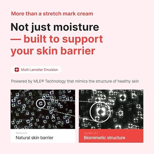 ATOPALM Maternity Care Stretch Mark Cream, 150ml 5 Fl Oz, Canola Oil Postpartum Skin Care| Pregnancy Red Lines Relief | Skin Swelling Elasticity Improvement| Gentle Body Moisturizing | Kbeauty thumbnail 5