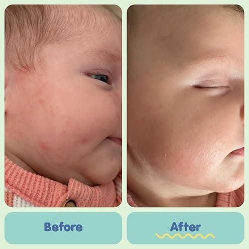 TUBBY TODD All Over Ointment Baby Eczema Cream, Everyday Multi-Purpose Baby Skin Relief Cream, Sensitive and Dry Skin, Rash & Irritation - Steroid & Gluten Free, Fragrance-Free, 8 oz, 2 Pack thumbnail 5