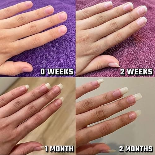 Radiant Nail Growth Oil, Nail Strengthener, Cuticle Oil for Nails, For Moisturize Strengthen Nail Care Oil, Finger Edge Manicure Nourishing Pen, Anti-hangbnail removal, Nail Skin Edge Care thumbnail 7