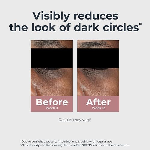 Eucerin Radiant Tone Eye Cream Dark Circle Corrector, Eye Brightening Cream with Thiamidol and Hyaluronic Acid, Helps Reduce the Look of Eye Puffiness, 0.5 Oz Tube thumbnail 4