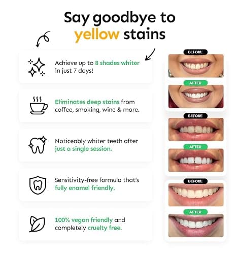 Whites Beaconsfield Teeth Whitening Strips, 28 Strips (14-Day Treatment) – Non-Peroxide Formula, Enamel-Safe, Brighten Teeth Fast, Removes Coffee, Wine, Smoke Stains, Safe for Sensitive Teeth thumbnail 2