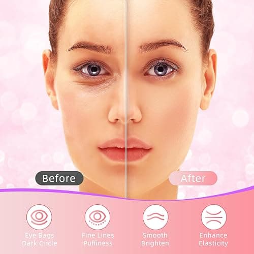 USTELIR Under Eye Patches, 40 Pairs Eye Mask for Dark Circles, Puffy Eyes, Undereye Bags,Wrinkles,Eye Mask Patches with Rose, Eye Treatment Skin Care for Men & Women Gift thumbnail 4