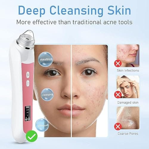 Blackhead Remover Vacuum, USB Interface Type Pore Vacuum, Black Head Extractions Tool with Camerafor, Men and Women Pore Cleaner, 3 Adjustment Modes & 6 Suction Heads(Light Pink) thumbnail 4
