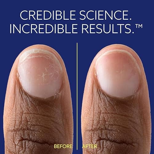 ePhD Bond Repair Nail Treatment, Nail Repair that Strengthens, Restores & Rebuilds Brittle Nails, Strengthens from Within, Formula for Damaged, or Post-Gel Nails, Use Alone or as a Polish Base thumbnail 4