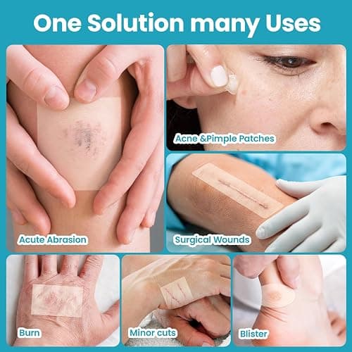Umaeost Hydrocolloid Roll for Wound Care: 2IN*6.5FT - Waterproof Ultra Thin Self Adhesive Patch for Blisters Acne Bedsores Pressure Diabetic Ulcers - DIY Size thumbnail 3