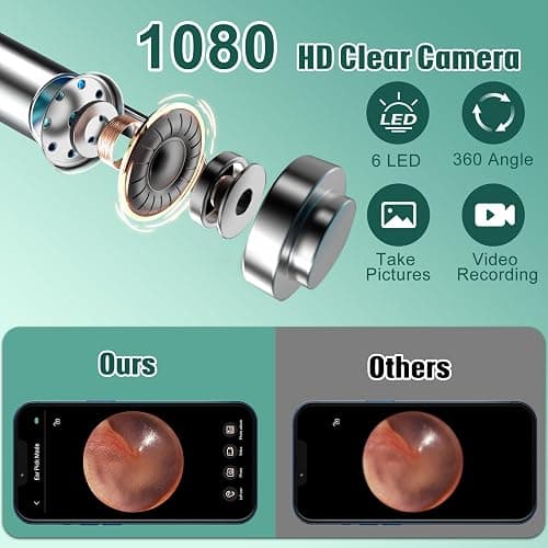 LMECHN Ear Wax Removal, Ear Cleaner with 7 Pcs Ear Set, Ear Wax Removal Tool Camera with 1080P Ear Otoscope & 6 LED Lights, Wireless Ear Pick for Ear Cleaning with 6 Ear Spoons Black thumbnail 2