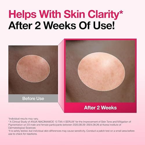 Anua Niacinamide 10 + TXA 4 Serum, Korean Skincare, 1.01 fl.oz | Dark Spot Care, Hyaluronic Acid, Tranexamic Acid, Lightweight & Hydrating All-in-One Daily Facial Serum for Glass Skin thumbnail 5