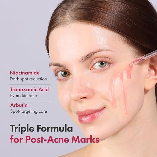 TOSOWOONG Niacinamide 10% + Tranexamic Acid 4% Serum, Arbutin 2%, Hyaluronic Acid, TXA Facial Serum, Glass Skin, Clarifying, Radiant Complexion with Natural Color, Korean Skin care, 33ml, 1.11 fl.oz. thumbnail 2