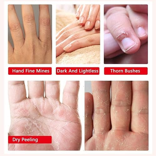 Liefiet Hand Peel Mask Moisturizing Gloves 5Pack, Hydrating Hand Masks Repair Dry Cracked Hands, Skin Moisturizer for Soft and Smooth Touch thumbnail 2