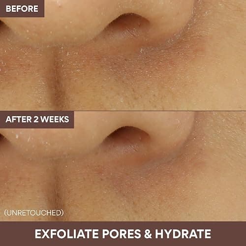 Innisfree Super Volcanic Clay Mask, Premium Korean Skincare with AHA and Natural Clusters for Deep Pore Detox, Gentle Exfoliation, Oil Control thumbnail 7