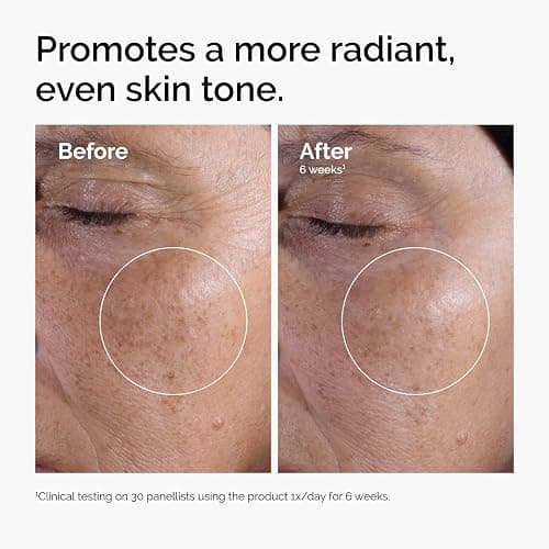 The Ordinary Glycolic Acid 7% Exfoliating Toner, Brightening and Smoothing Daily Toner for More Even-Looking Skin Tone thumbnail 2
