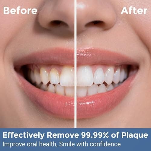 INSMART Water Flosser for Teeth: Portable Travel Flossers Set for Teeth cleaning with 5 Modes Cordless Dental Electric Flosser for Oral Care,Rechargeable Floss DIY Mode IPX7 Waterproof thumbnail 4
