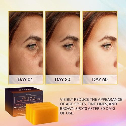 VALITIC Kojic Acid Dark Spot Remover Soap Bars with Vitamin C, Retinol, Collagen, Turmeric - Original Japanese Complex Infused with Hyaluronic Acid, Vitamin E, Shea Butter, Castile Olive Oil (3 Pack) thumbnail 2
