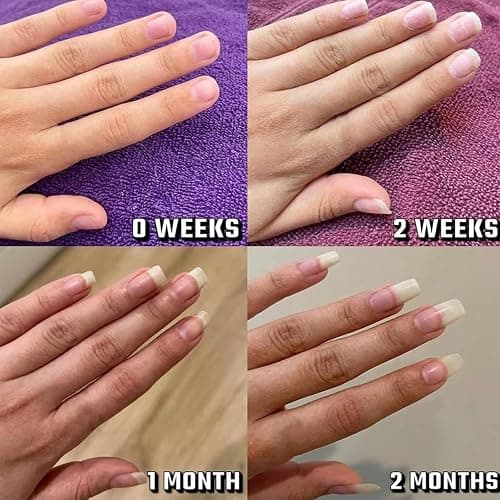 Explcior Lyra Cosmetic Ongles, Huile Cuticules Ongles, Huile de Croissance des Ongles Rayonnante, Sérum Cosmétique for Hydrater, Renforcer et Éclaircir Le Soin des Ongles(2pcs) thumbnail 6