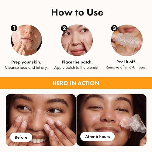 nose pimple patch thumbnail 4