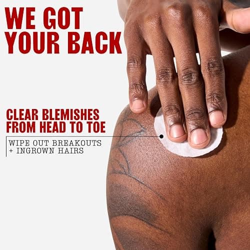 Thayers Blemish Clearing Acne Pads thumbnail 8