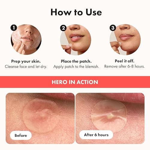 Hero Cosmetics Mighty Patch Original – Hydrocolloid Patch for Pimples, Overnight Acne Blemish & Zit Stickers for Sensitive Skin, (72 Count) thumbnail 4