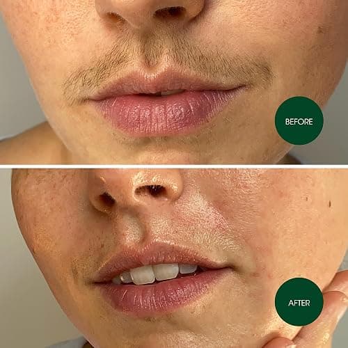 Nad's Facial Wax Strips - Hypoallergenic All Skin Types - Facial Hair Removal For Women - At Home Waxing Kit with 20 Face Wax Strips + 4 Calming Oil Wipes + Skin Protection Powder (Pack of 2) thumbnail 6