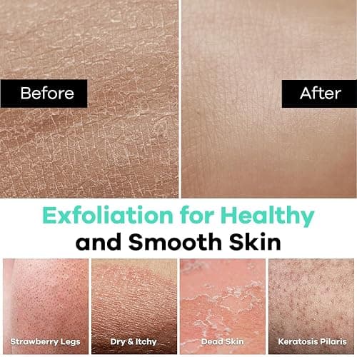 Dermasuri - Deep Exfoliating Glove - Korean Exfoliating Mitt & Body Scrubber - Keratosis Pilaris Treatment Scrub - Self Tanner Mitt & Ingrown Hair Exfoliator - Shower Gloves for Women & Men - (2 Pack) thumbnail 4