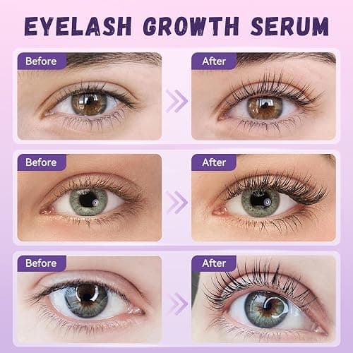 Lash Serum Natural & Vegan Eyelash Growth Serum for Longer, Thicker, Fuller Lashes Nourishing & Conditioning Formula Safe for Sensitive Eyes - 5ml thumbnail 3