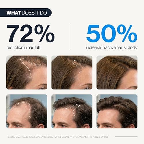 Be Bodywise Hair Growth Serum Roll On - 5% Saw Palmetto, 3% Rosemary Oil for Hair Growth, 3% Fenugreek,1% Caffeine Herbasome | Serum for Hair Loss & Hair Regrowth For Men & Women 25ml/0.84 fl oz thumbnail 2