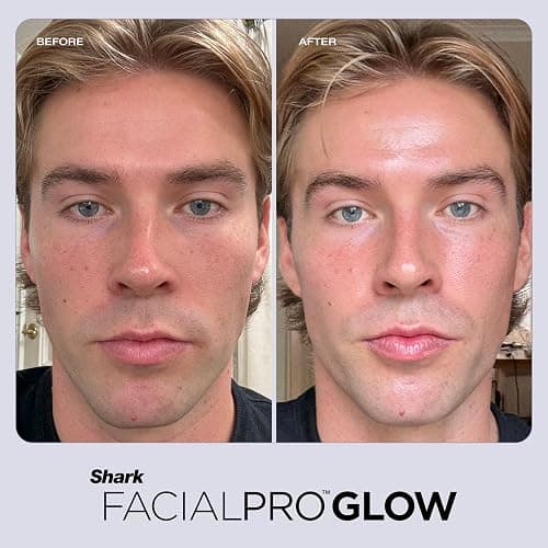 Shark FacialPro Glow at-Home Hydro-Powered Facial System with DePuffi Hot & Cold Therapy – Professional Spa Skincare Device for Pore Cleansing, Hydration, & Radiant Glow, Lilac, FH320PL thumbnail 13