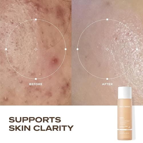 Blanc Nature Heartleaf Calming Toner, Soothing and Hydrating Toner for All Skin Types with Heartleaf Extract, Centella Asiatica and Panthenol, Korean Skincare for Glass Skin, 5.07 fl oz (150 ml) thumbnail 4
