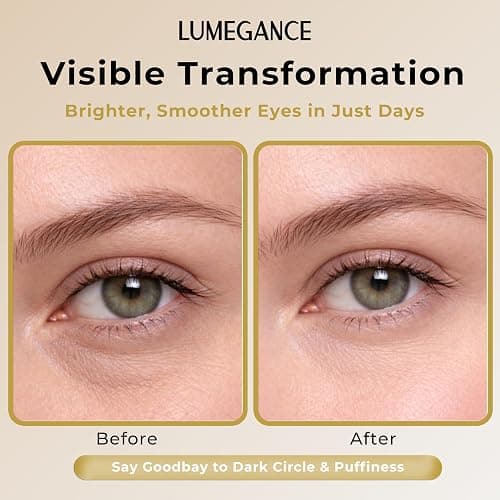 LUMEGANCE Daily Renew Eye Cream, 5% Niacinamide Under Eye Brightener Cream with 5-Peptide Complex & Shea Butter, Firming, Dark Circle, Hydrating, Smooth Fine Lines, Korean Skin Care 30ml thumbnail 7