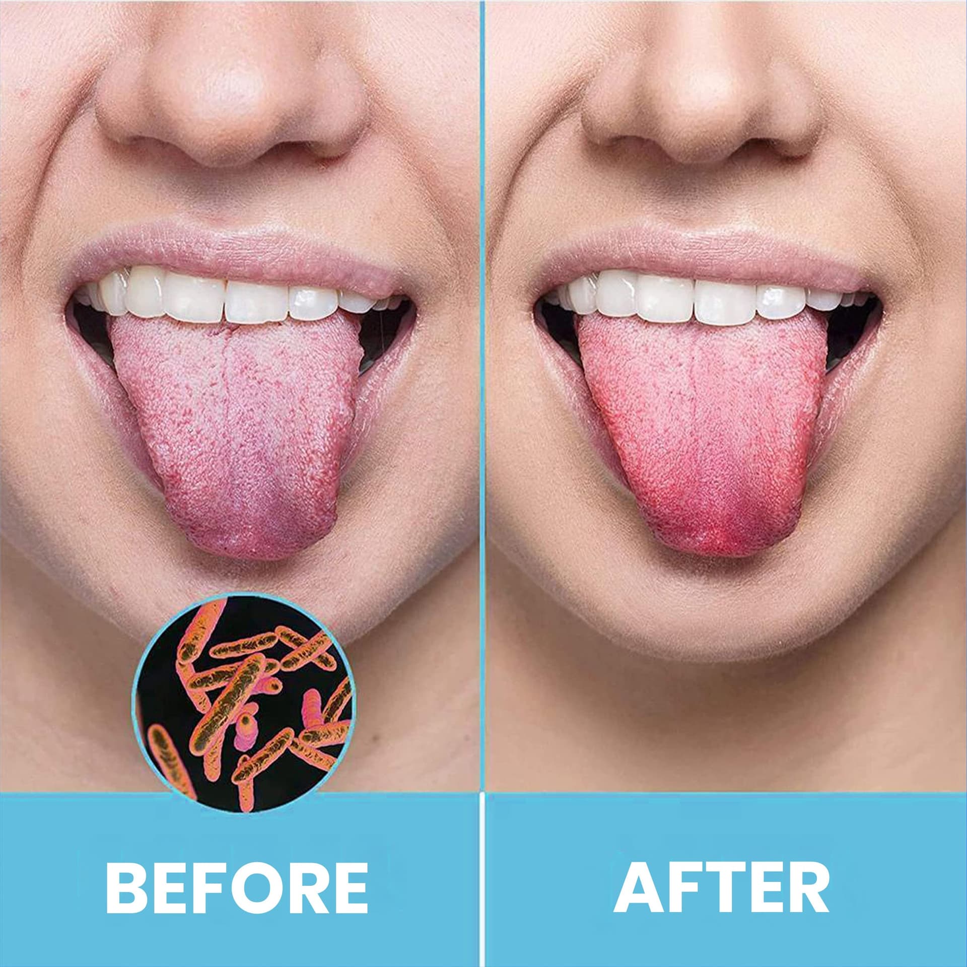 Adult Tongue Scraper by HOKIN (1 Piece Oral Care Package) Stainless Steel Tongue Cleaners Reduce Bad Breath 100% Metal Sturdy Scrapers Hygiene Product for Men and Women thumbnail 4