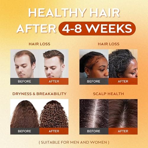 Batana Oil for Hair Growth Dr Sebi, 100% Raw Organic Batana Hair Mask from Honduras, Wild Growth Hair Oil, Scalp Oil Promotes Hair Thickness, Prevents Loss for Men & Women, 4.06 fl oz thumbnail 4