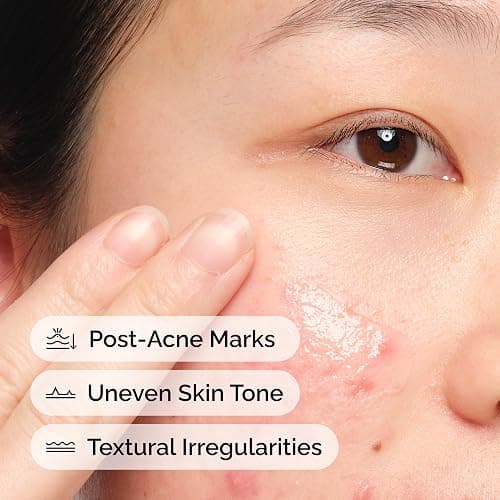 The Ordinary Aloe 2% + NAG 2% Solution, Soothes Skin and Targets Post-Acne Marks, 1 Fl Oz thumbnail 4