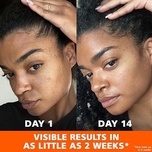 Palmer's Skin Success Anti-Dark Spot Fade Cream with Vitamin E and Niacinamide, for All Skin Types 2.7 Ounce thumbnail 6