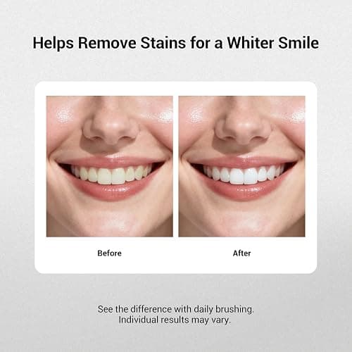 MSDRWIKEY Popping 7Pro Deep Whitening Toothpaste with 7 Probiotics - Advanced Formula for Stain Removal and Gum Health - Fluoride-Free, Enamel-Safe, Fresh Mint Flavor, 4.23 oz (3) thumbnail 6