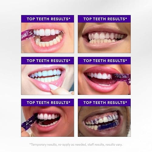 Hismile V34 Whitening Strips, Teeth Whitening Strips, Purple Tooth Whitening, Purple V34 Whitening Strips, Tooth Stain Treatment, Combining Whitening and Colour Correction thumbnail 5