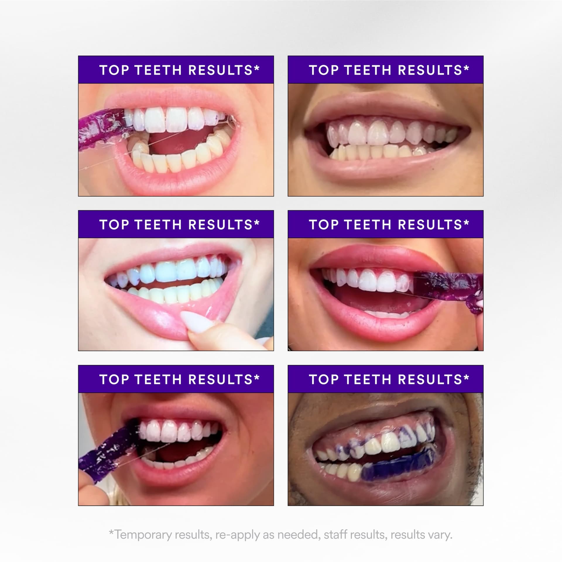 Hismile V34 Purple Teeth Whitening Strips, 14 Count, Peroxide-Free, Brightens Teeth in 30 Minutes, Combines Whitening and Colour Correction thumbnail 5