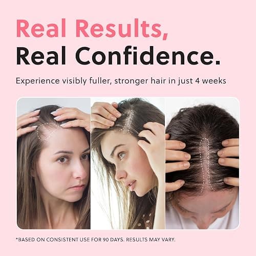 Revolutionary Hair Regrowth Serum - Fights Hair Thinning & Hair Loss - Strengthens, Thickens and Accelerates Hair Growth- Non Greasy and Hormone Free Spray For Scalp- 50ml - Forhair thumbnail 3