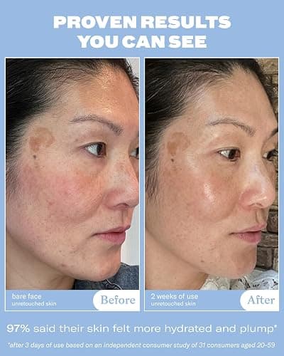 Then I Met You The Giving Essence, Vegan, Cruelty-Free Korean Skincare with 5% Niacinamide, Fermented Galactomyces, Red Algae & Berries for Brightening & Hydration, Suitable for All Skin Types, 5.07oz thumbnail 3