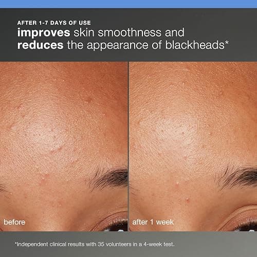 Dermalogica Discover Healthy Skin Kit - Includes: Precleanse, Face Wash, Face Exfoliator, & Moisturizer - Wash Away Impurities To Reveal Glowing Skin thumbnail 5