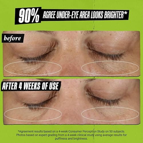 Kiehl's Avocado Eye Treatment, Under Eye Cream for Puffiness and Dark Circles, with Caffeine to Correct Bags, 99% Naturally Derived Non-Toxic Formula thumbnail 5