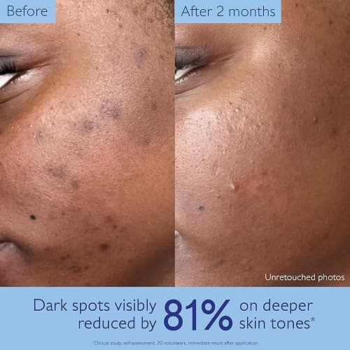 Caudalie Vinoperfect Brightening Dark Spot Serum Vitamin C Alternative thumbnail 4