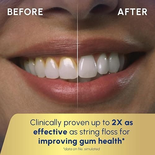 Waterpik Cordless Advanced 2.0 Water Flosser For Teeth, Gums, Braces, Dental Care With Travel Bag and 4 Tips, ADA Accepted, Rechargeable, Portable, and Waterproof, Black WP-582, Packaging May Vary thumbnail 5