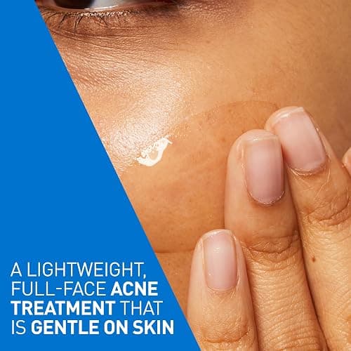 CeraVe Acne Control Gel For Face, Pimple & Pores, With Salicylic Acid, 3 Essential Ceramides, Niacinamides. Developed with Dermatologists, Non-Comedogenic, Oil-Free, Fragrance-Free, 40ml thumbnail 3