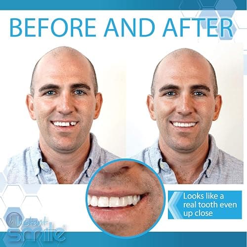 Instant Smile Complete Your Smile Temporary Tooth Replacement Kit - Replace a Missing Tooth in Minutes - Patented | Replace a Missing Tooth in Minutes, Patented thumbnail 5