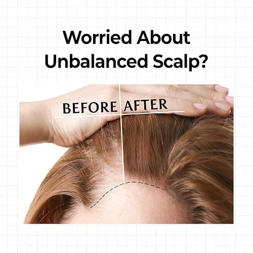 KUNDAL Hair Loss Serum & Caffeine Scalp Tonic thumbnail 3