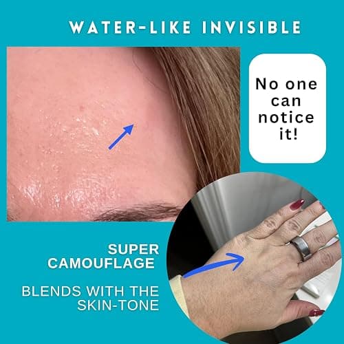 Original Korean Hydrocolloid Acne Pimple Patches, Spot Cover Stickers Absorb Pus, Shrink Pimples & Whiteheads, Scar-Guard Formula (K-Perfect Everyday Thin Pack, 56 Count, 3S) thumbnail 8